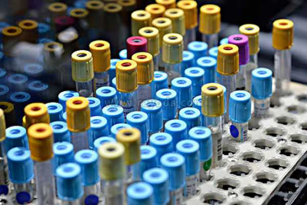 林志玲做试管婴儿是真的吗 林志玲为什么做试管婴儿